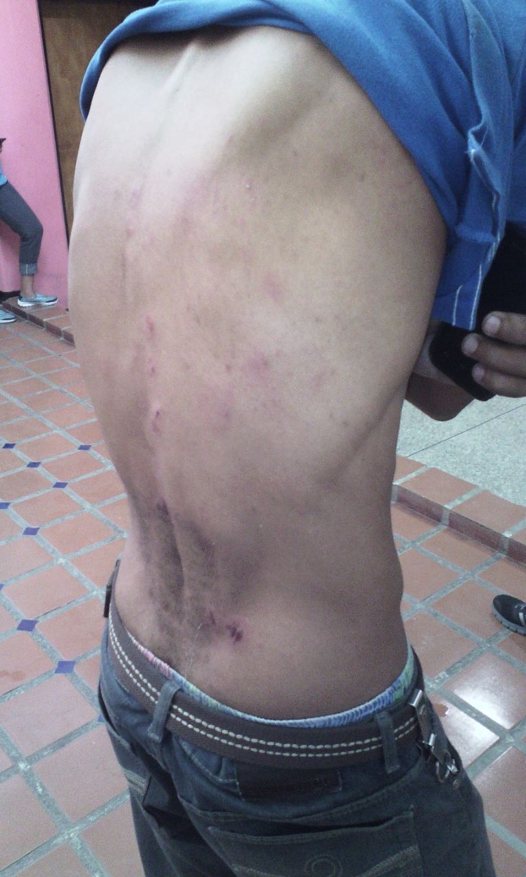 El reportero Luis Torres fue lanzado al suelo y pateado por un grupo de personas que intentaron despojarlo de su cámara. Foto Cortesía.
