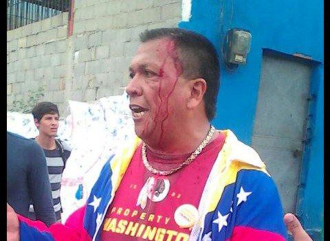 : IPYS Venezuela registra al menos 40 agresiones físicas contra trabajadores de medios. Foto. Cortesía CNP