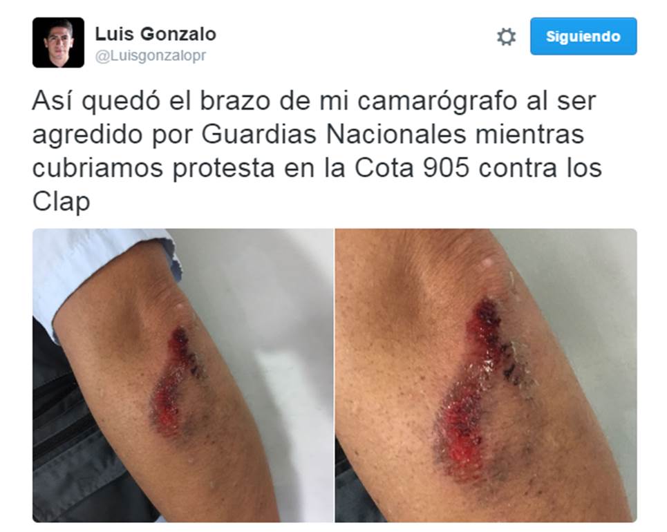 Resultado de la agresión cometida contra el reportero gráfico de Caraota Digital. Foto Cortesía. Luis Pérez.